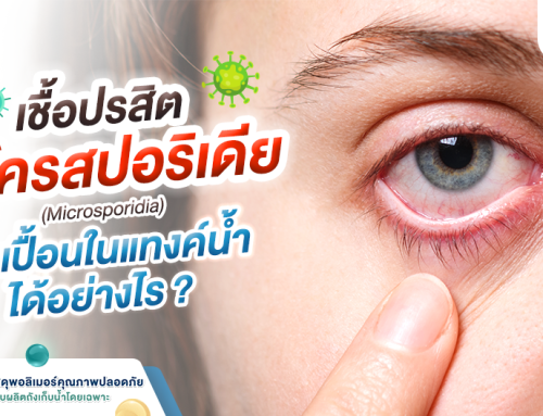 เชื้อปรสิตปนเปื้อนในแทงค์น้ำได้อย่างไร?